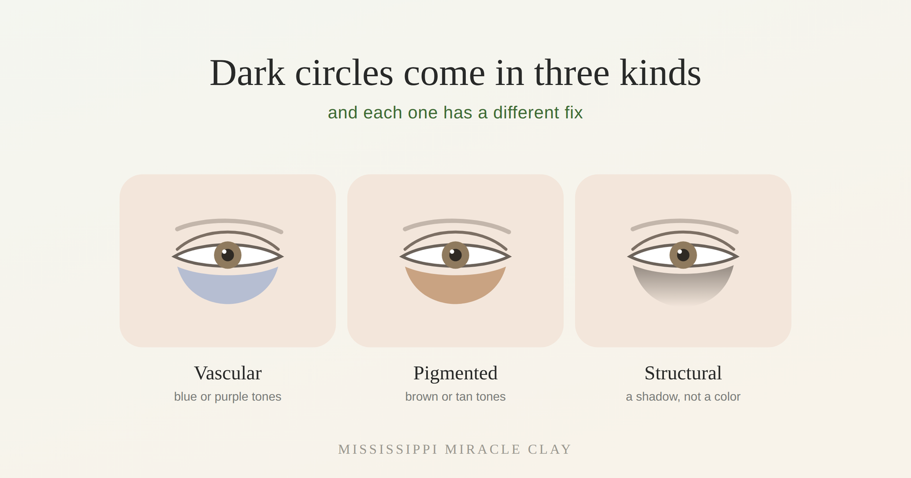 Dark circles come in three kinds, and each one has a different fix
