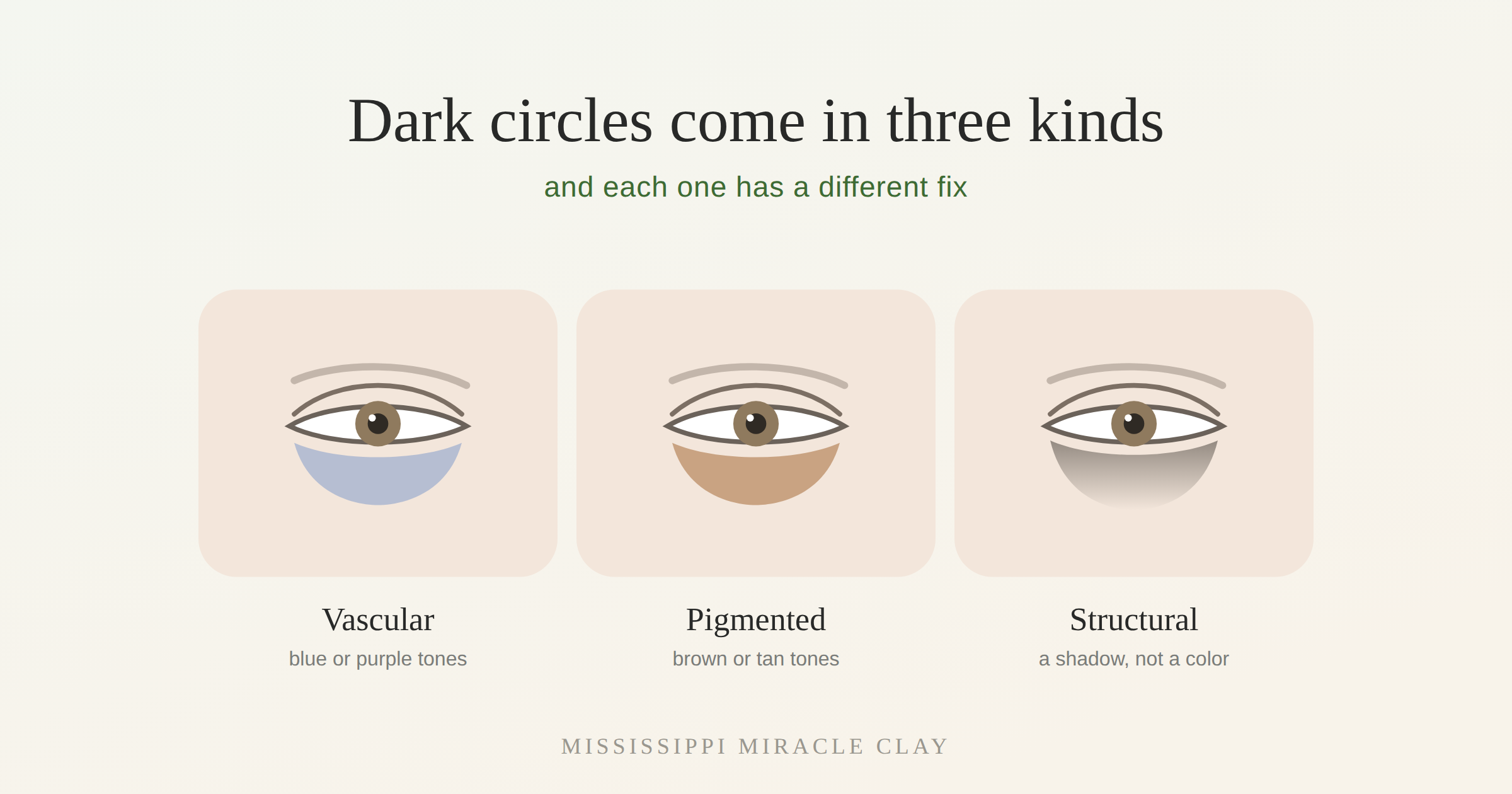Dark circles come in three kinds, and each one has a different fix
